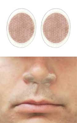 First Defense Nasal Screens First Defense Nasal Screens